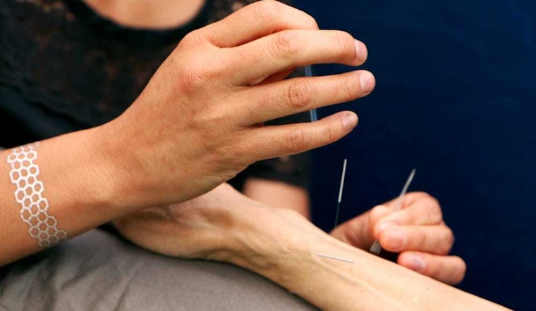 The 4 best acupuncture spots in Berkeley