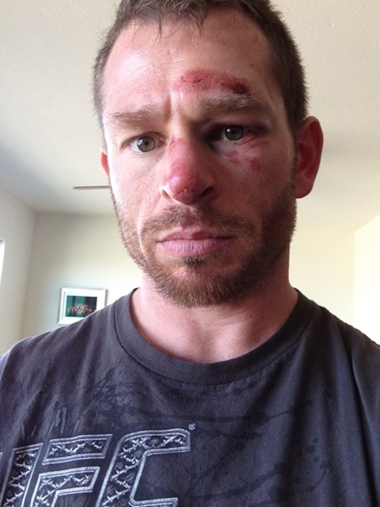 BREAKING: Castro Resident Viciously Assaulted and Robbed