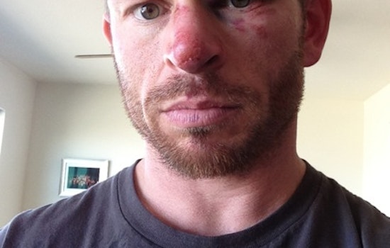 BREAKING: Castro Resident Viciously Assaulted and Robbed