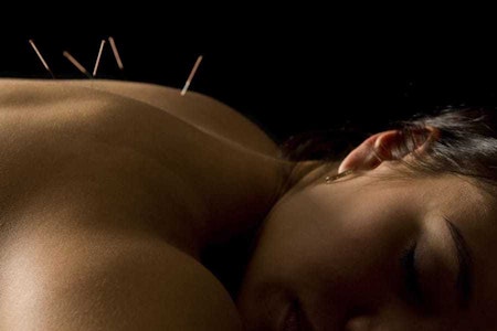 The 4 best acupuncture spots in Cambridge
