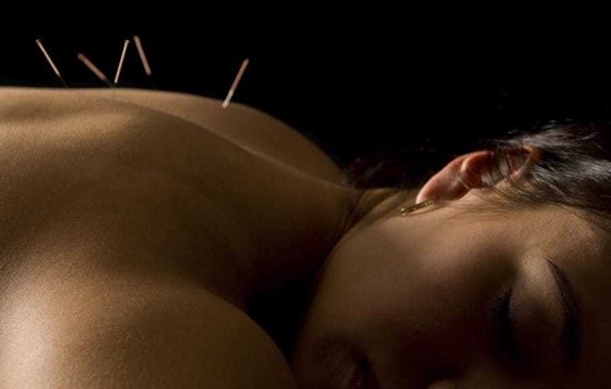The 4 best acupuncture spots in Cambridge