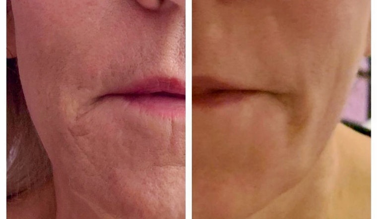 Skin care spot Serenity Aesthetics OC debuts in The Spectrum