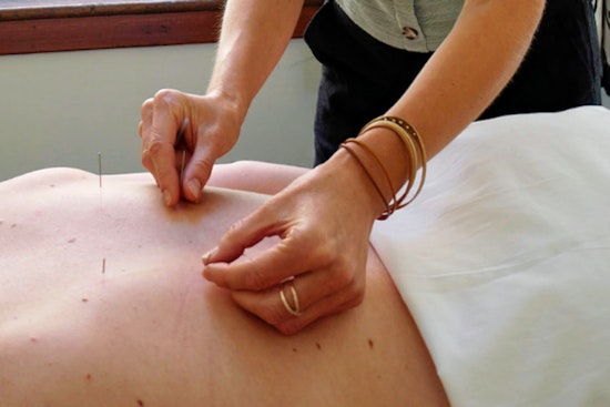 The 3 best acupuncture spots in Portland