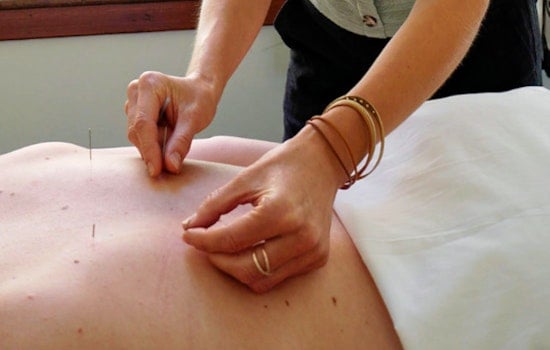 The 3 best acupuncture spots in Portland