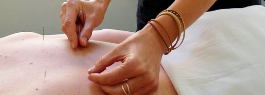 The 3 best acupuncture spots in Portland