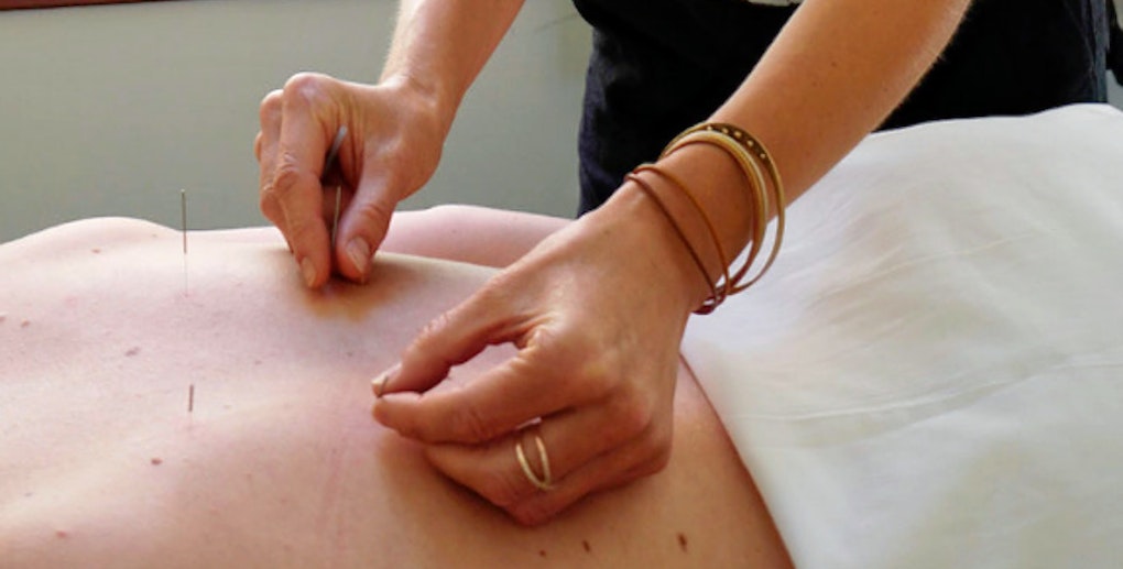 The 3 best acupuncture spots in Portland